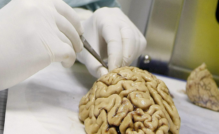 Un compuesto probado en ratones revierte daños del alzhéimer en las neuronas