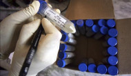 La tuberculosis infantil aumenta un 10% en Europa