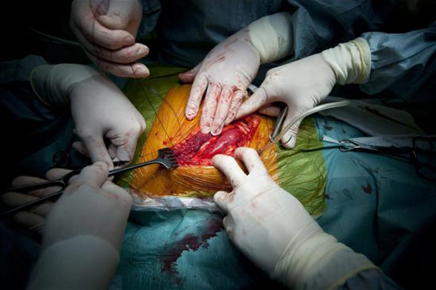 Una albanesa descubre 15 años después que los médicos le "robaron" un riñón