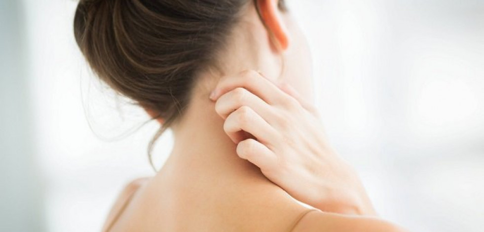Un nuevo tratamiento para calmar la molesta dermatitis atópica