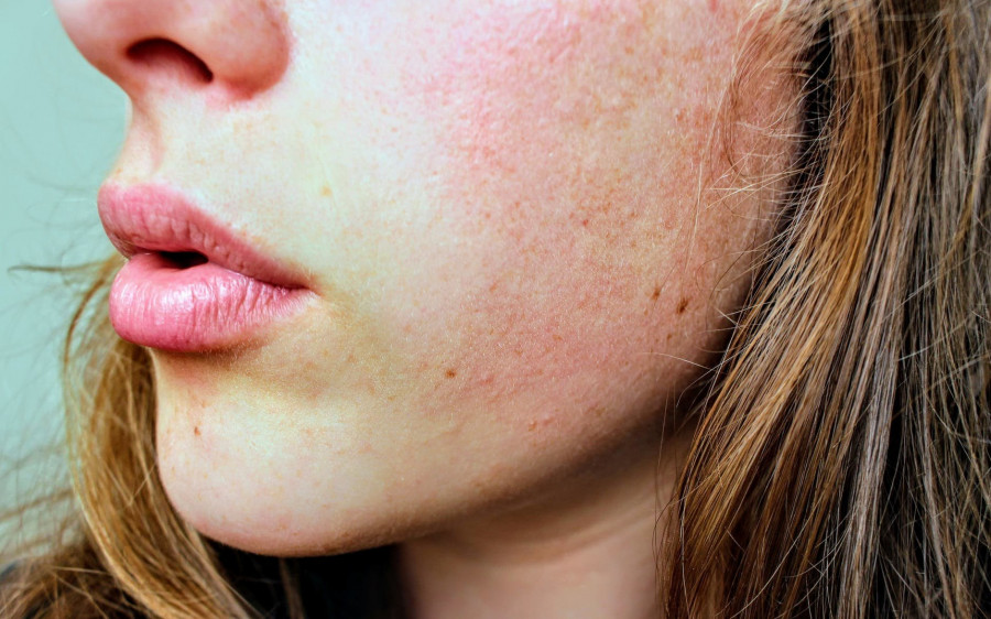 ¿Cuáles serán las mayores novedades en Dermatología en 2019?