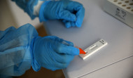 Un estudio señala que los anticuerpos de la covid persisten nueve meses tras la infección