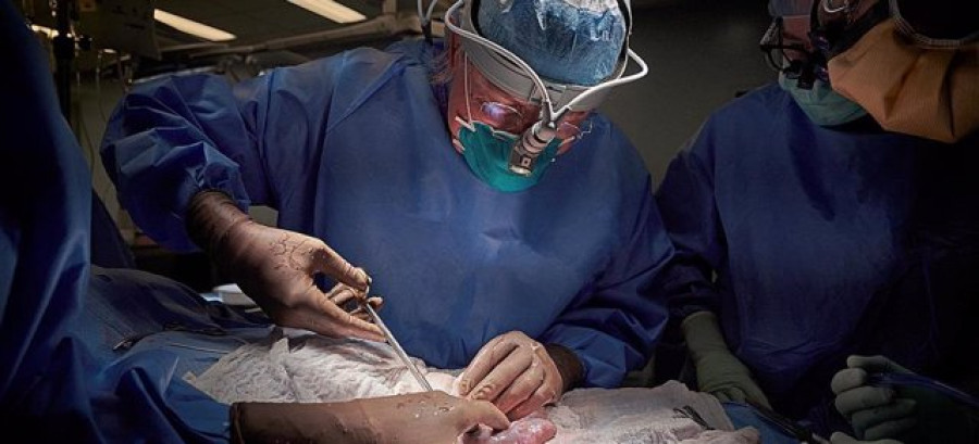 Científicos estadounidenses realizan el primer trasplante de un riñón de cerdo a un humano
