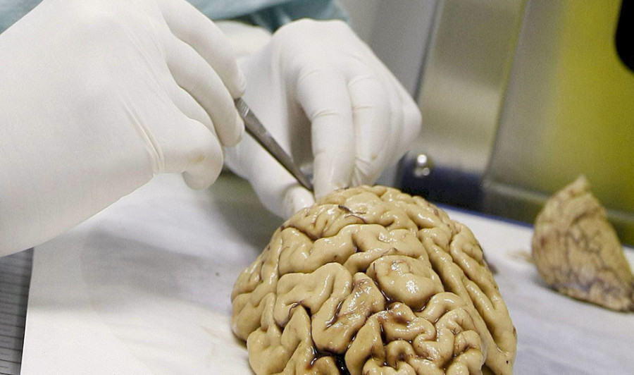 Un compuesto probado en ratones revierte daños del alzhéimer en las neuronas