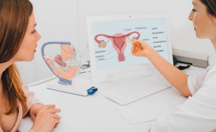 Dolores pélvicos y sangrado vaginal inapropiado, los síntomas habitualeles del cáncer de ovario
