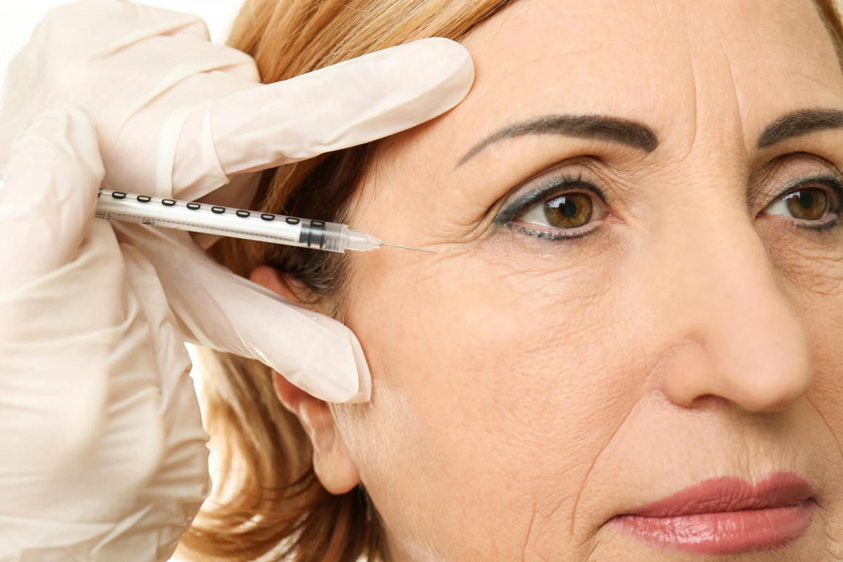 Eliminar arrugas botox