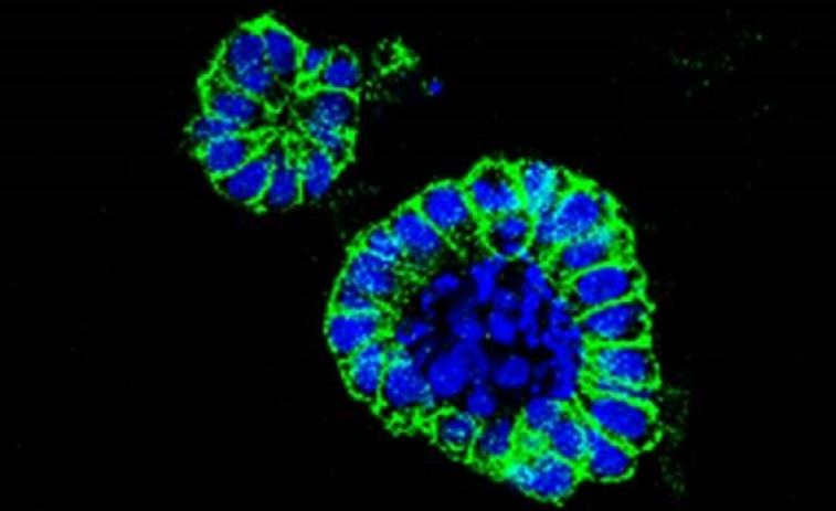 Una técnica en ratones multiplica por cien la potencia de unas células contra el cáncer