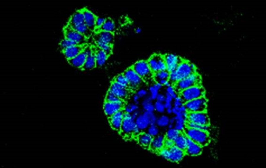Una técnica en ratones multiplica por cien la potencia de unas células contra el cáncer