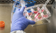 La inteligencia artificial, al servicio de la investigación en enfermedades raras