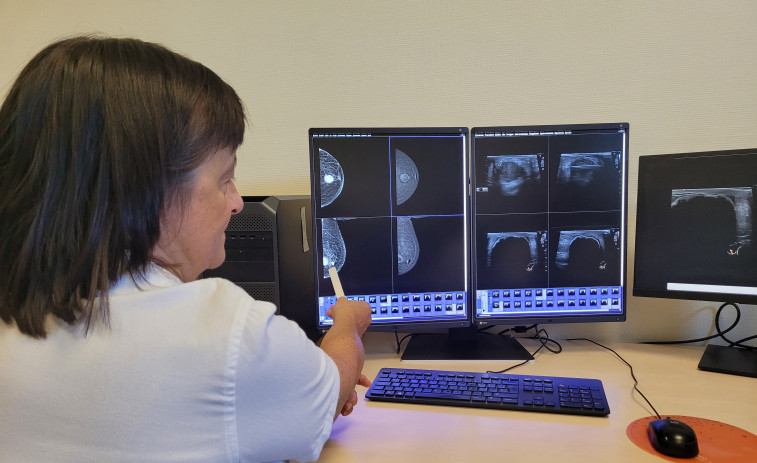 El hospital de A Coruña formará a especialistas gallegos para que usen su pionera técnica para hacer mastectomías
