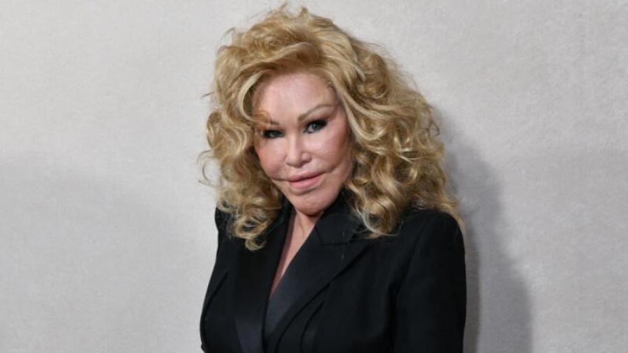 Fallece Jocelyn Wildenstein, famosa por sus extremas cirugías y conocida como 'Catwoman'