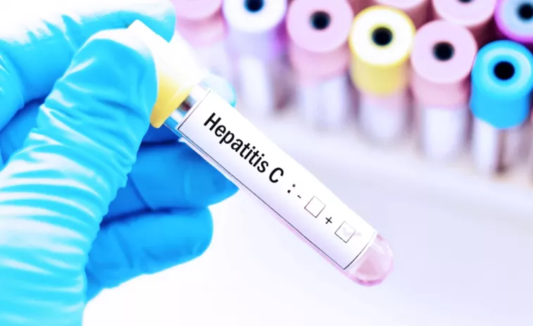 El Sergas detecta 372 positivos de hepatitis C durante su plan de erradicación