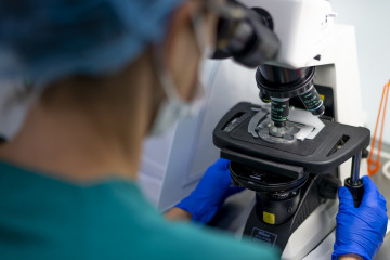 Sociedad 2 HEPATITIS C ESPAÑA