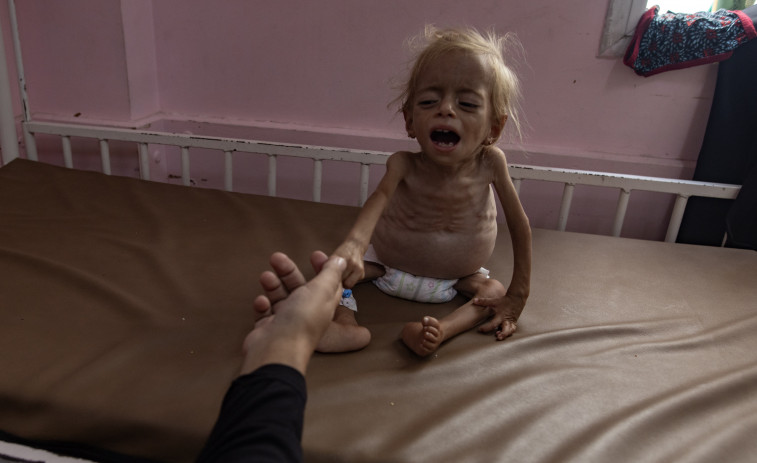La cifra de niños muertos en Gaza por desnutrición se eleva a 100 desde el inicio de la ofensiva