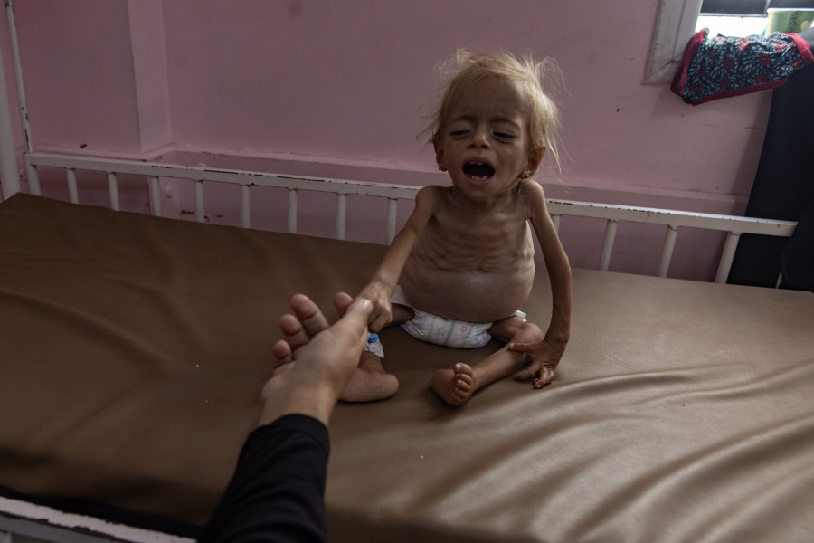 La cifra de niños muertos en Gaza por desnutrición se eleva a 100 desde el inicio de la ofensiva